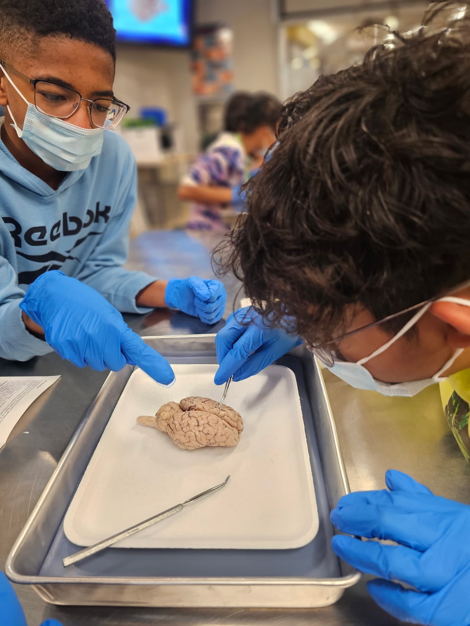 Close-up of brain dissection with scalpel tools